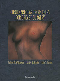 Vorderes Coverbild Circumareolar Techniques for Breast Surgery