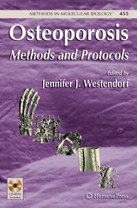 Vorderes Coverbild Osteoporosis