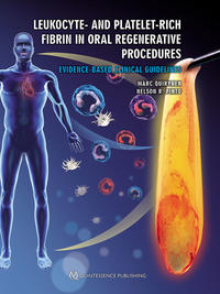 Vorderes Coverbild Leukocyte- and Platelet-Rich Fibrin in Oral Regenerative Procedures