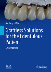 Vorderes Coverbild Graftless Solutions for the Edentulous Patient