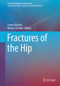 Vorderes Coverbild Fractures of the Hip