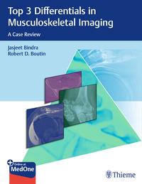 Vorderes Coverbild Top 3 Differentials in Musculoskeletal Imaging
