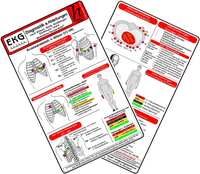 Vorderes Coverbild EKG Diagnostik & Ableitungen 2025 - Medizinische Taschen-Karte