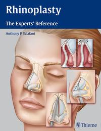 Vorderes Coverbild Rhinoplasty