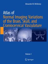 Vorderes Coverbild Atlas of Normal Imaging Variations of the Brain, Skull, and Craniocervical Vasculature