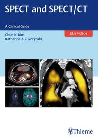 Vorderes Coverbild SPECT and SPECT/CT
