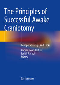 Vorderes Coverbild The Principles of Successful Awake Craniotomy