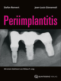 Vorderes Coverbild Periimplantitis