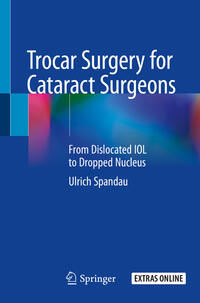 Vorderes Coverbild Trocar Surgery for Cataract Surgeons