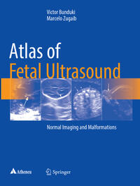 Vorderes Coverbild Atlas of Fetal Ultrasound