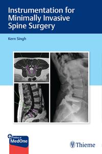 Vorderes Coverbild Instrumentation for Minimally Invasive Spine Surgery