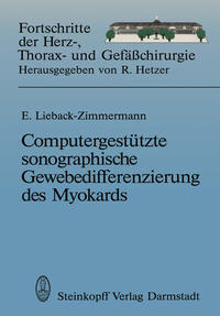 Vorderes Coverbild Computergestützte sonographische Gewebedifferenzierung des Myokards