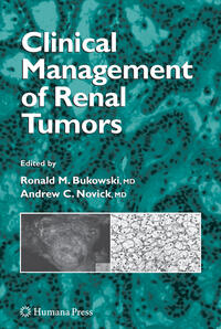 Vorderes Coverbild Clinical Management of Renal Tumors