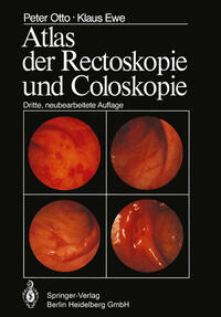Vorderes Coverbild Atlas der Rectoskopie und Coloskopie