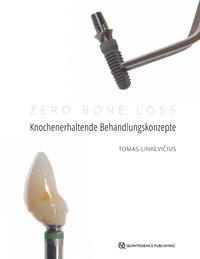 Vorderes Coverbild Zero Bone Loss: Knochenerhaltende Behandlungskonzepte