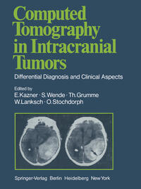 Vorderes Coverbild Computed Tomography in Intracranial Tumors