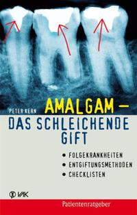 Vorderes Coverbild Amalgam - das schleichende Gift