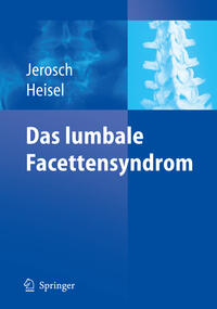 Vorderes Coverbild Das lumbale Facettensyndrom