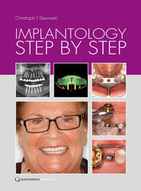 Vorderes Coverbild Implantology Step by Step
