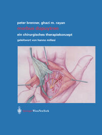 Vorderes Coverbild Morbus Dupuytren