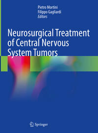 Vorderes Coverbild Neurosurgical Treatment of Central Nervous System Tumors