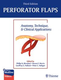 Vorderes Coverbild Perforator Flaps