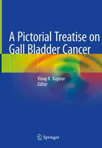 Vorderes Coverbild A Pictorial Treatise on Gall Bladder Cancer