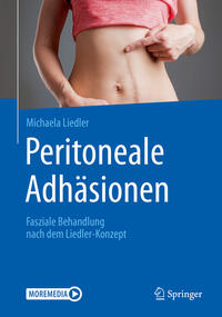 Vorderes Coverbild Peritoneale Adhäsionen