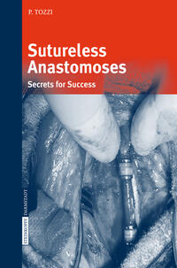 Vorderes Coverbild Sutureless Anastomoses