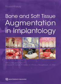 Vorderes Coverbild Bone and Soft Tissue Augmentation in Implantology