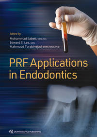 Vorderes Coverbild PRF Applications in Endodontics