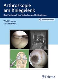 Vorderes Coverbild Arthroskopie am Kniegelenk