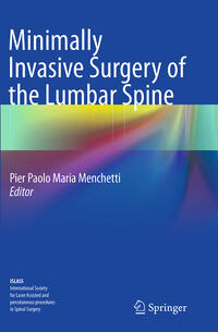 Vorderes Coverbild Minimally Invasive Surgery of the Lumbar Spine