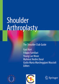 Vorderes Coverbild Shoulder Arthroplasty