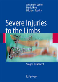 Vorderes Coverbild Severe Injuries to the Limbs