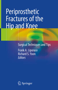 Vorderes Coverbild Periprosthetic Fractures of the Hip and Knee