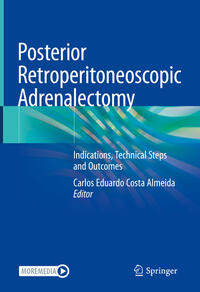 Vorderes Coverbild Posterior Retroperitoneoscopic Adrenalectomy