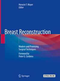 Vorderes Coverbild Breast Reconstruction