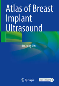 Vorderes Coverbild Atlas of Breast Implant Ultrasound