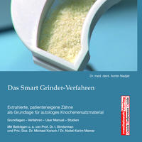 Vorderes Coverbild Das Smart Grinder-Verfahren
