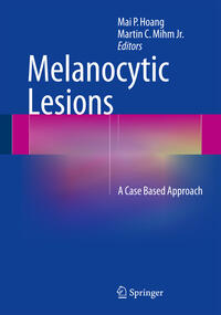 Vorderes Coverbild Melanocytic Lesions