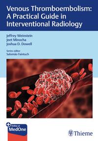 Vorderes Coverbild Venous Thromboembolism