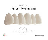 Vorderes Coverbild Keramikveneers