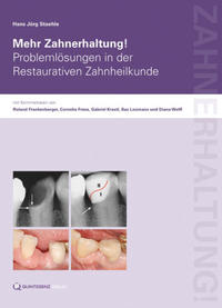 Vorderes Coverbild Mehr Zahnerhaltung!